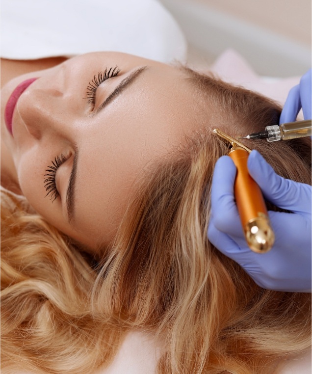 Intradermoterapia Capilar - tratamento para queda de cabelo