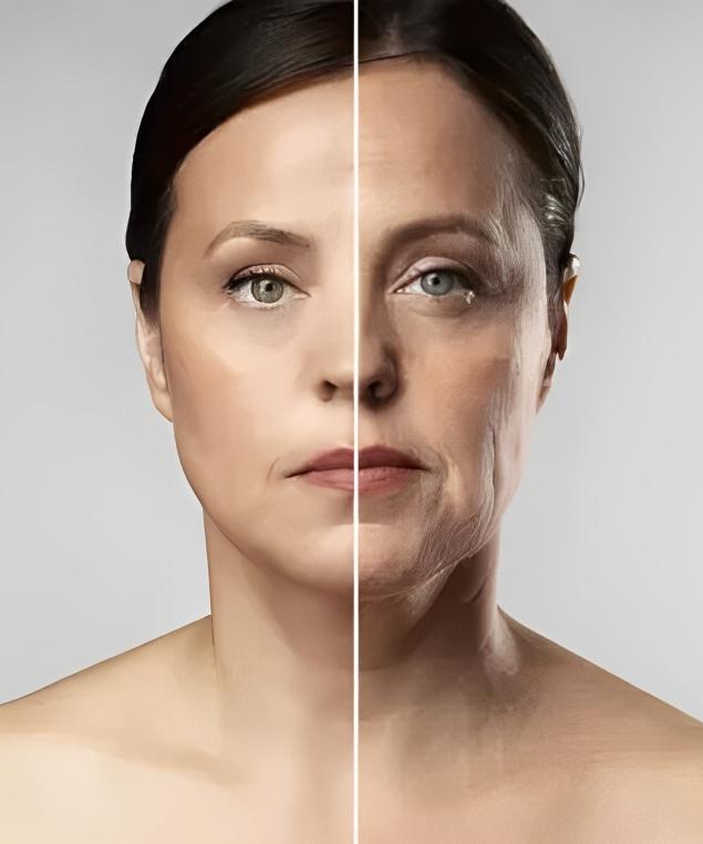 Rejuvenescimento facial com Laser Fotona em Cuiabá